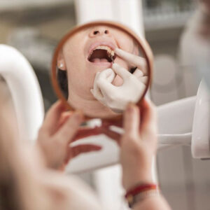 Comparison chart showing the price of dental implants and crowns in Los Algodones Mexico versus the United States.