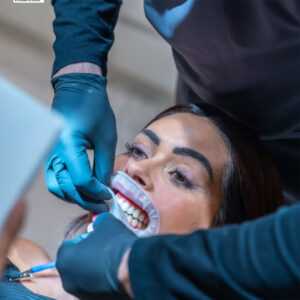 Comparison of dental crown costs in Algodones Mexico featuring high-quality Zirconia and E-max restorations.