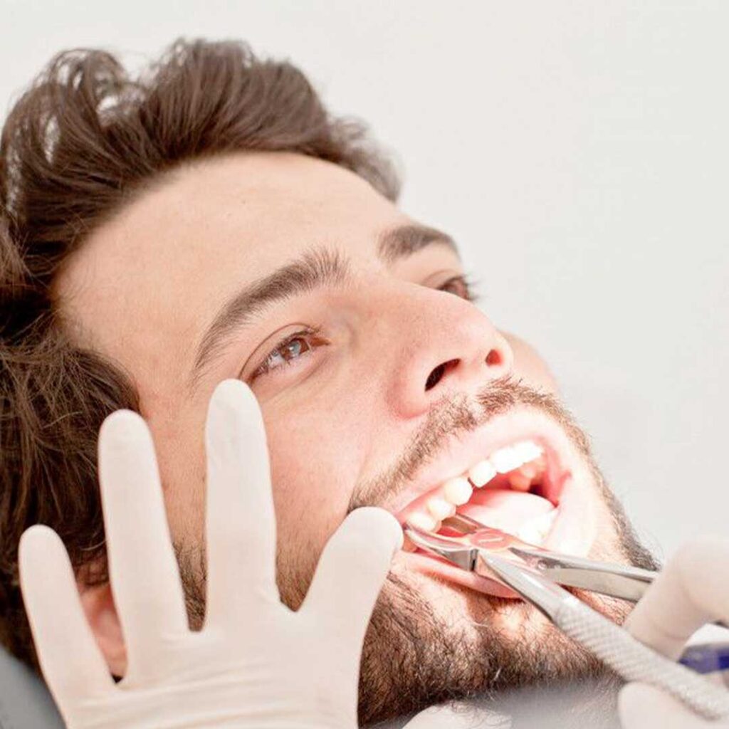 Panoramic dental X-ray showing impacted wisdom teeth ready for removal by an oral surgeon in Los Algodones.